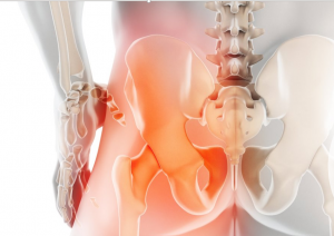 Read more about the article There’s Nothing Hip About Hip Pain!