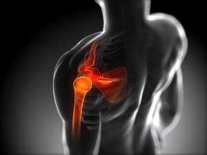Read more about the article You Don’t Have To Shoulder That Shoulder Pain!