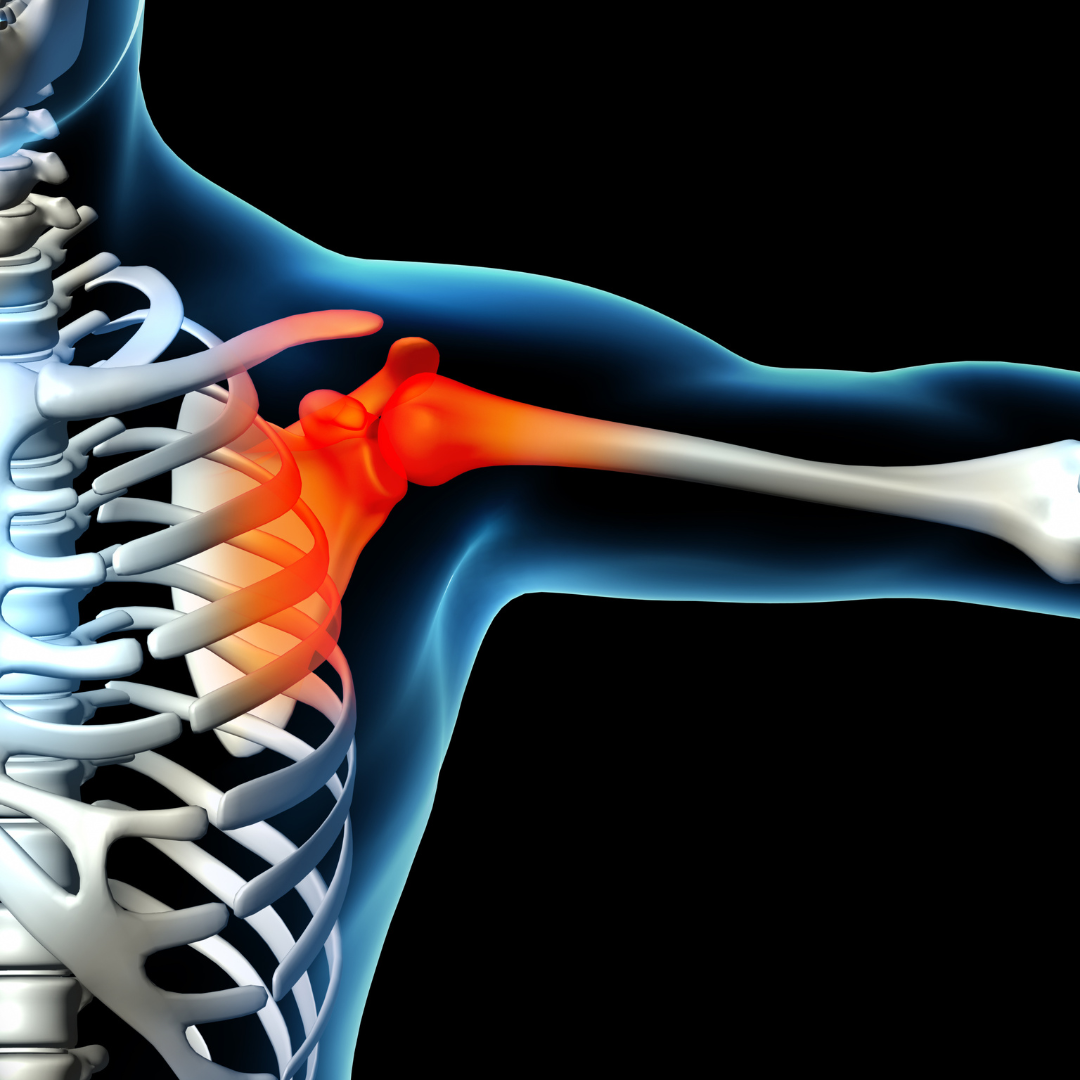 Read more about the article The Results PT Short Guide to Shoulder Pain