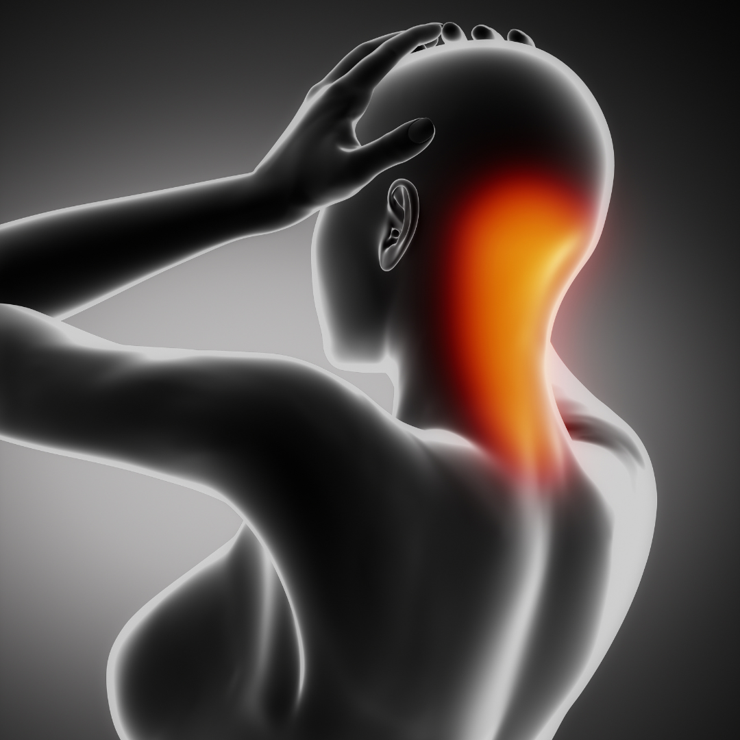 Read more about the article How Neck Injuries Cause Headaches