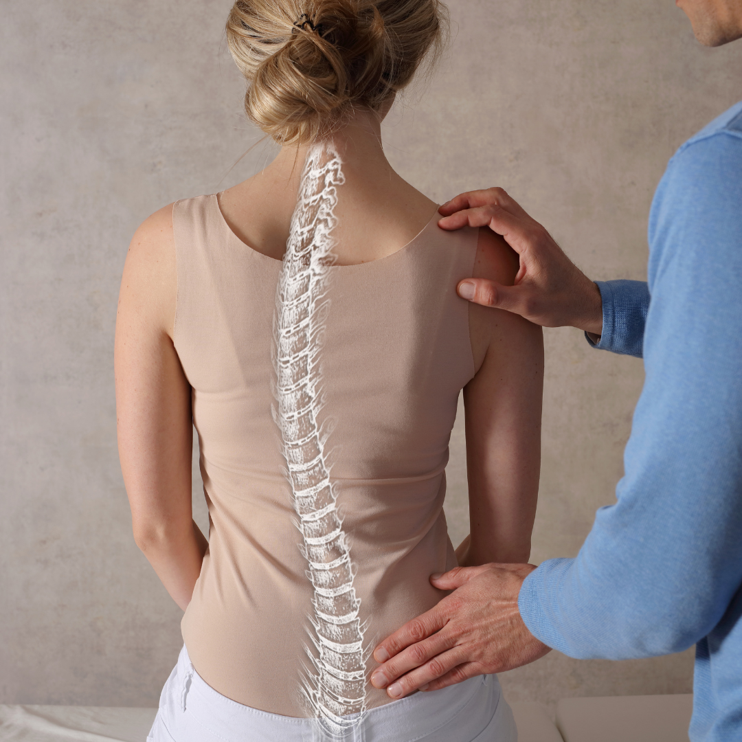 Read more about the article Women and Scoliosis: Body Implications