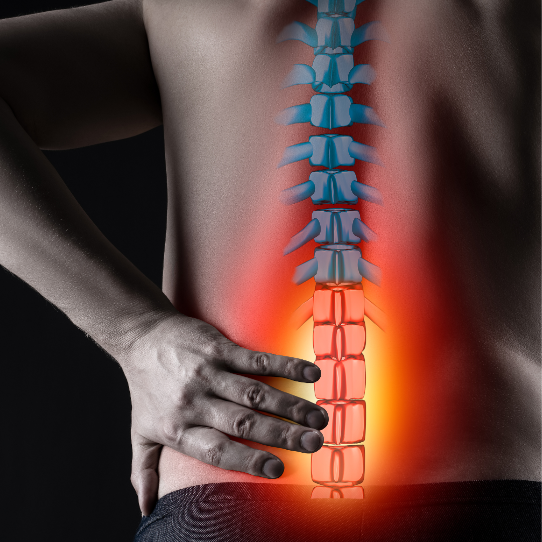 Read more about the article Physical Therapy and Sciatica Recovery